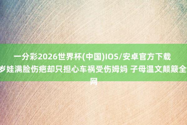 一分彩2026世界杯(中国)IOS/安卓官方下载 3岁娃满脸伤疤却只担心车祸受伤姆妈 子母温文颠簸全网